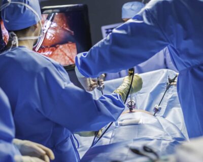 Laparoscopic-Hernia-Surgery-in-Guwahati